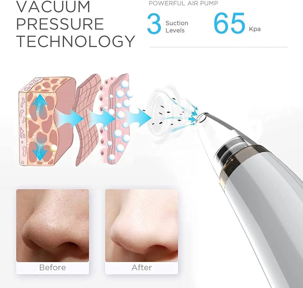 Blackheads Removal